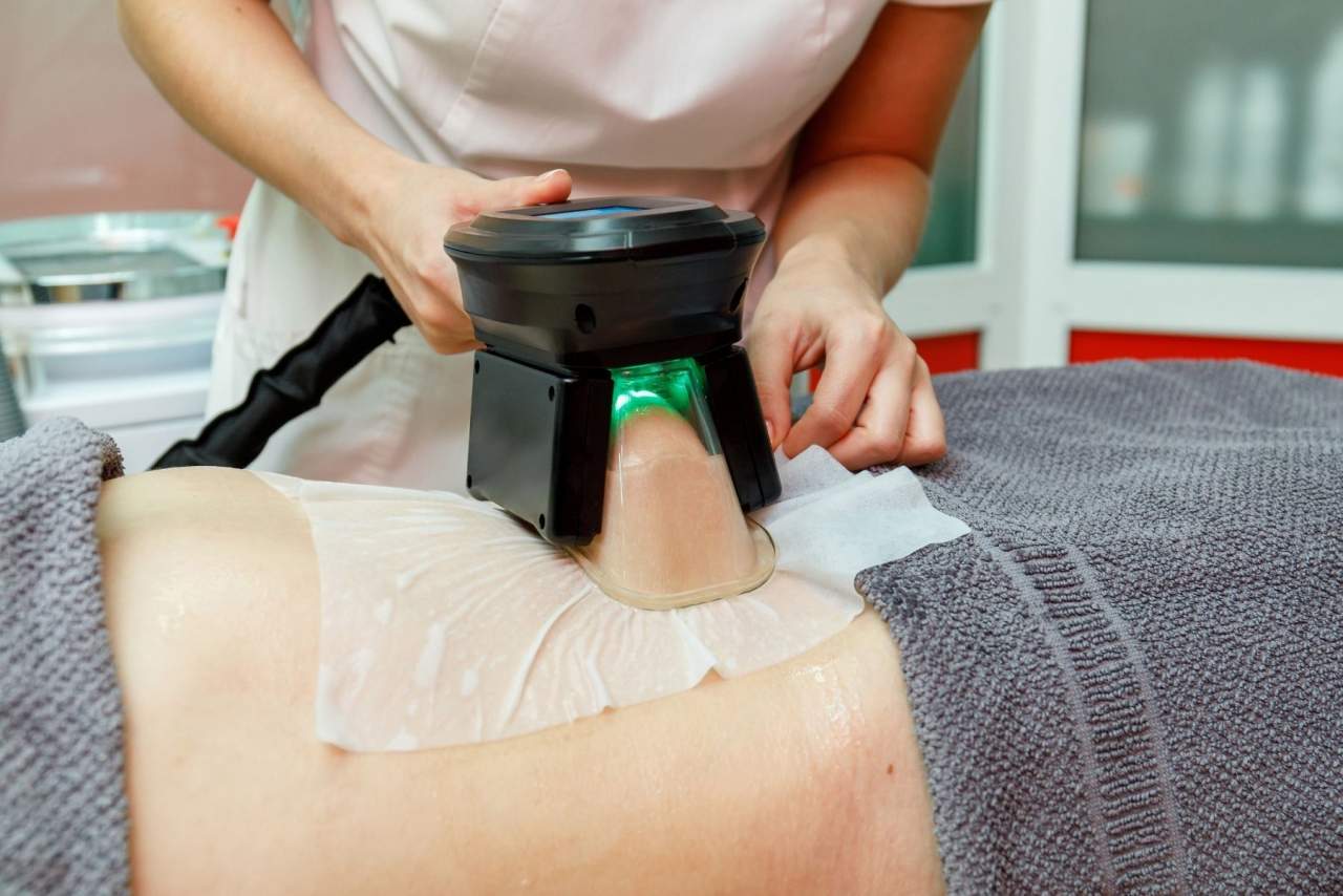 Dra. Alfonsina Uriburu y su criolipolisis médica: eliminar grasa localizada en Santiago de Compostela