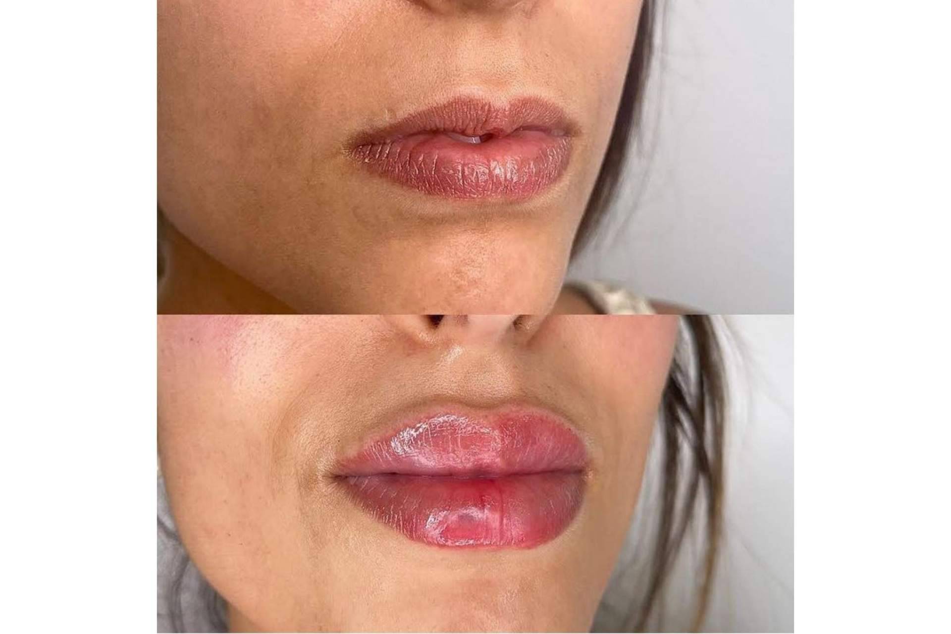 Los tratamientos estéticos del doctor Castellar revitalizan la expresión facial tanto de mujeres como de hombres