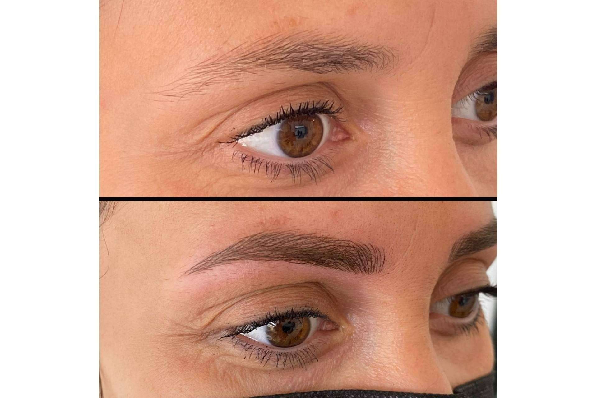 El microblading de la Dra. Julieta Gil permite lucir un rostro siempre perfecto