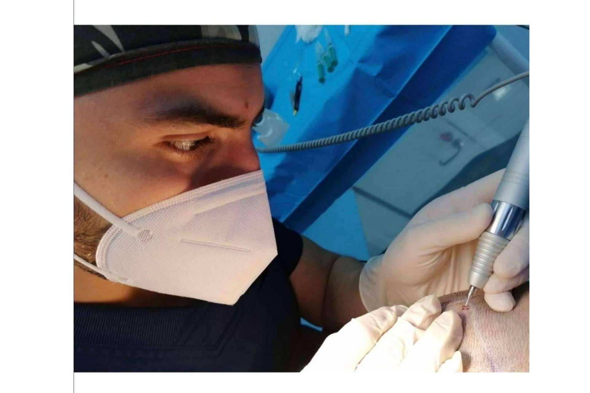 La fase del desierto capilar: ¿En qué momento se cae el pelo implantado?, según Doctor Bern
