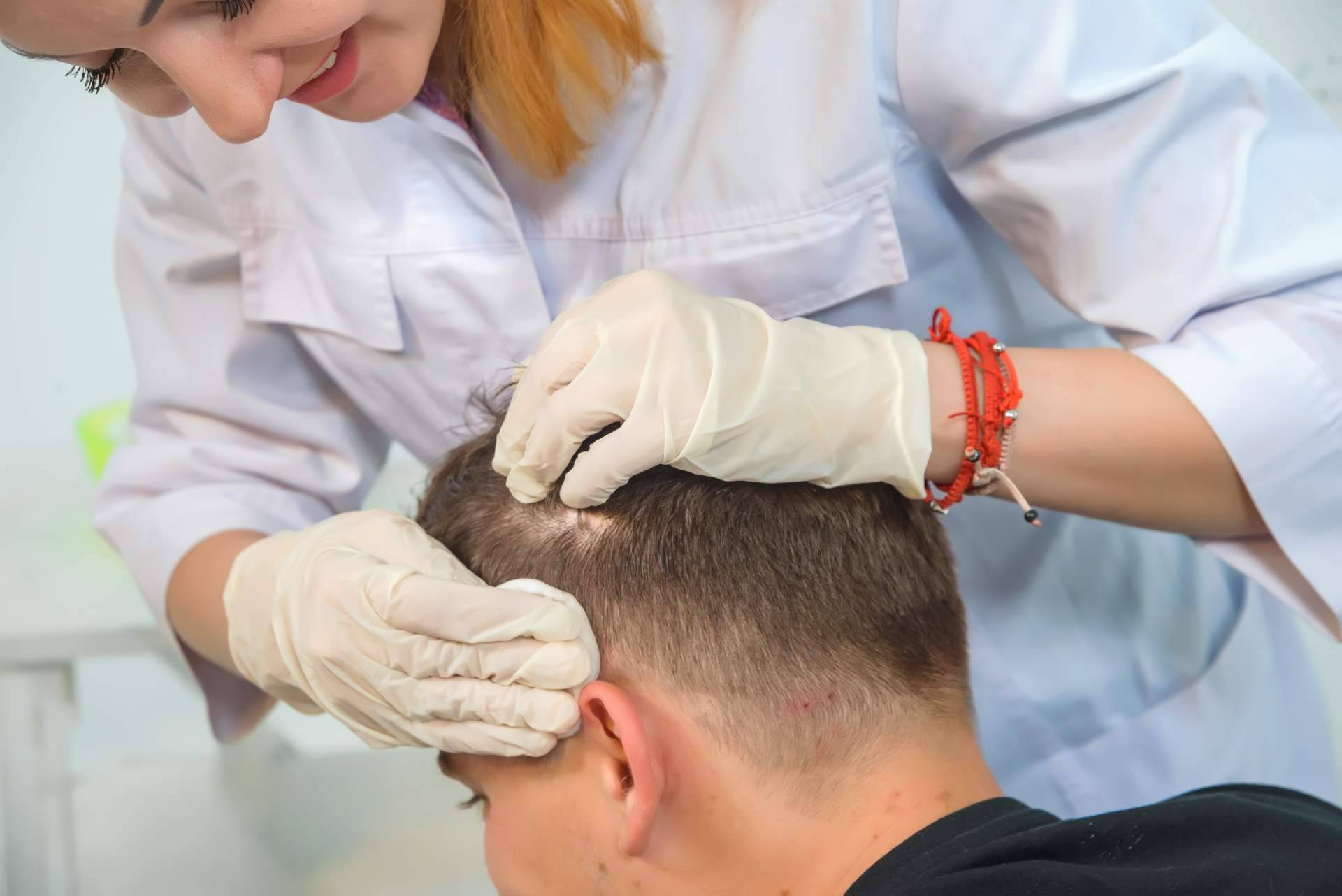 ¿Cuáles son las diferencias entre láser capilar y mesoterapia capilar? Tratamientos de Élite Capilar