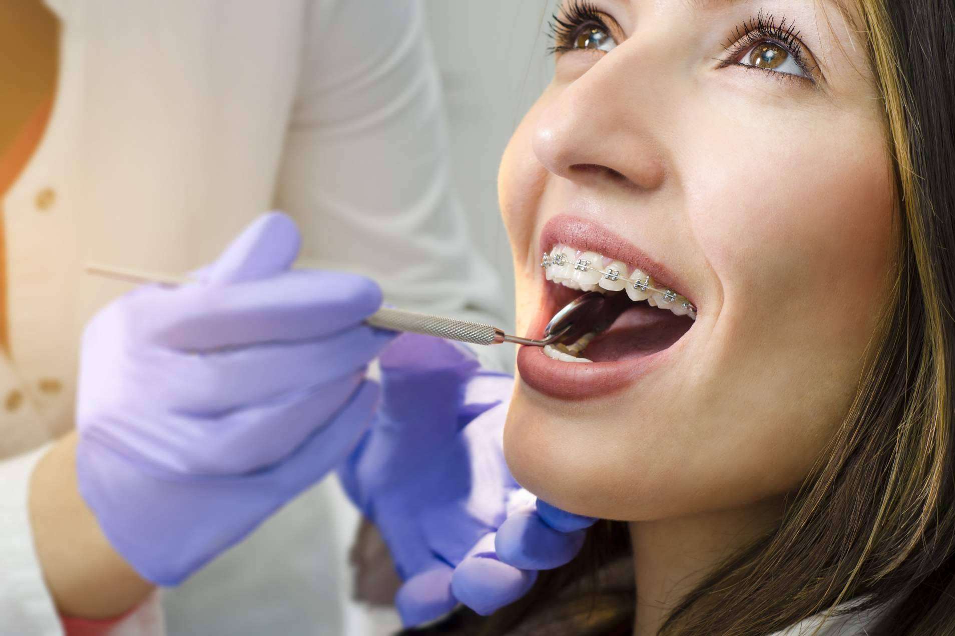 ¿Para qué sirve un tratamiento de ortodoncia con brackets? Helident Clínica Dental