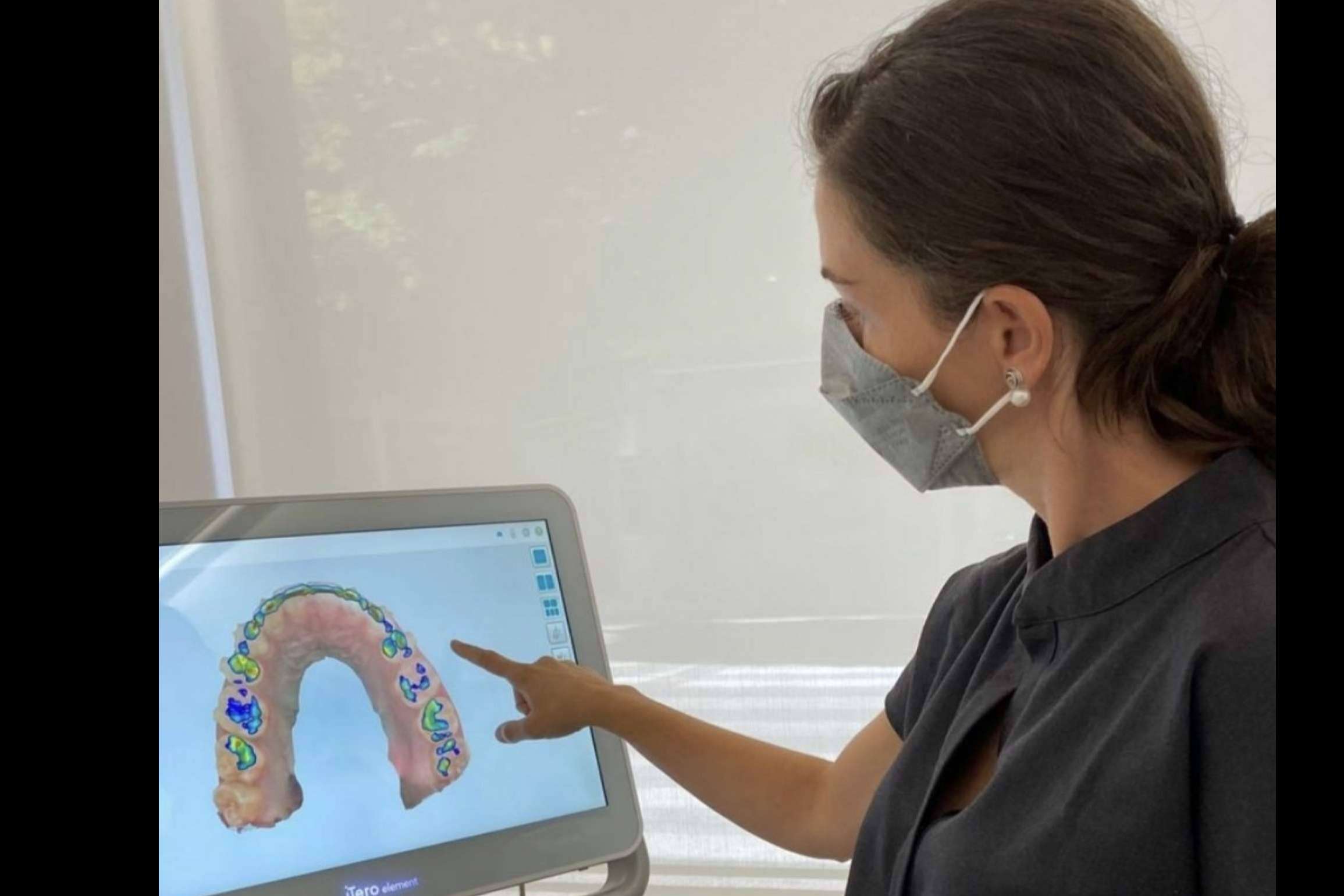 Ventajas que ofrece el tratamiento Invisalign, por Clínica dental Carmen Díaz