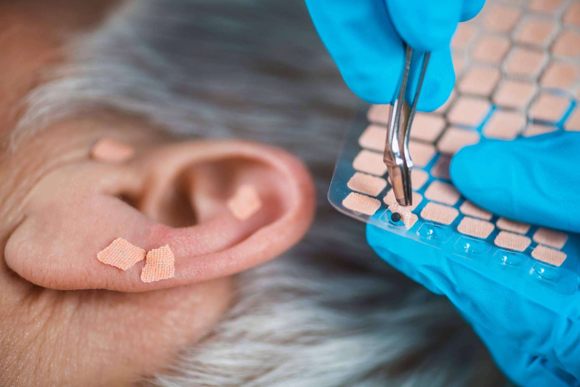 Auriculoterapia, técnica natural de Rambla 6 coadyuvante en el tratamiento del dolor, ansiedad y adicciones