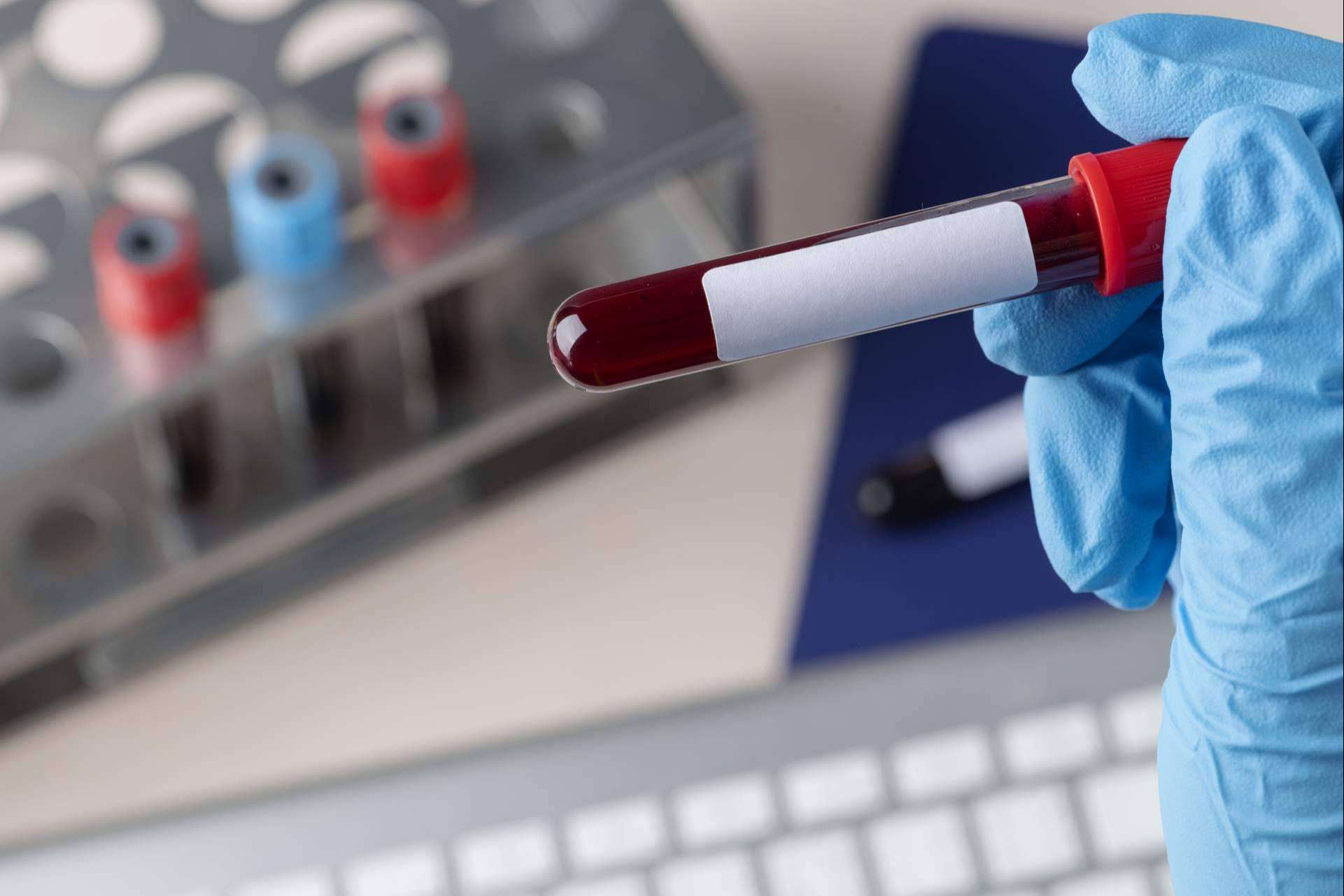 La importancia que tienen las pruebas genéticas en la salud actual, por Crezen