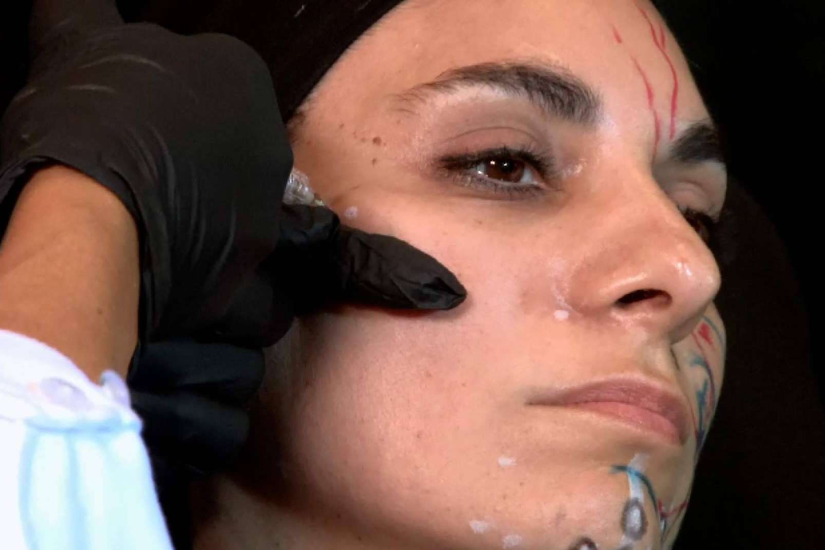 Masterhub, el congreso de medicina estética